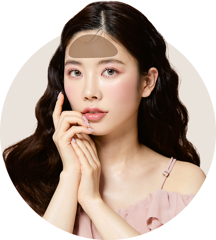 이마